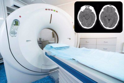 ​1万一次的PET-CT是什么？值得做吗？提醒：3类人群较合适