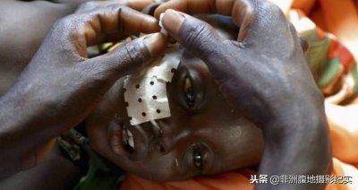 ​非洲的苍蝇嗜血成性以咬人恶名远扬，被叮咬后长睡不醒还胎生