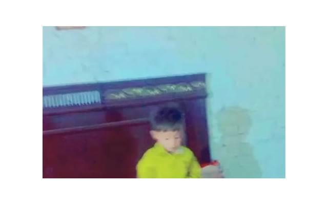 孩子性早熟会有哪些表现？性早熟该怎么治疗