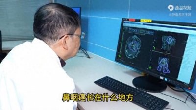 ​鼻咽癌长什么样？以医生的视角，用一张图像带大家看看鼻咽...