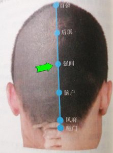 ​每日——强间穴