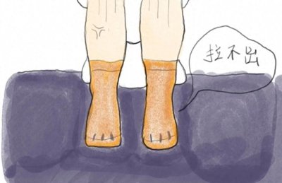 ​经穴之升清降浊，可调理便秘的天枢穴